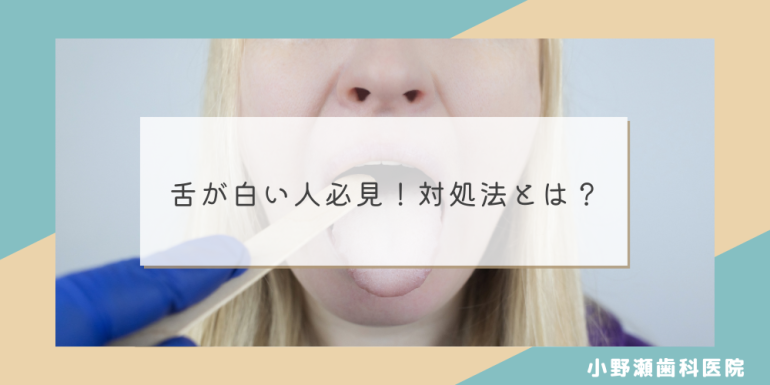 舌が白い人必見！対処法とは？新宿オークタワー歯科クリニック