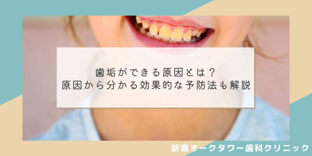 歯垢ができる原因とは？原因から分かる効果的な予防法も解説