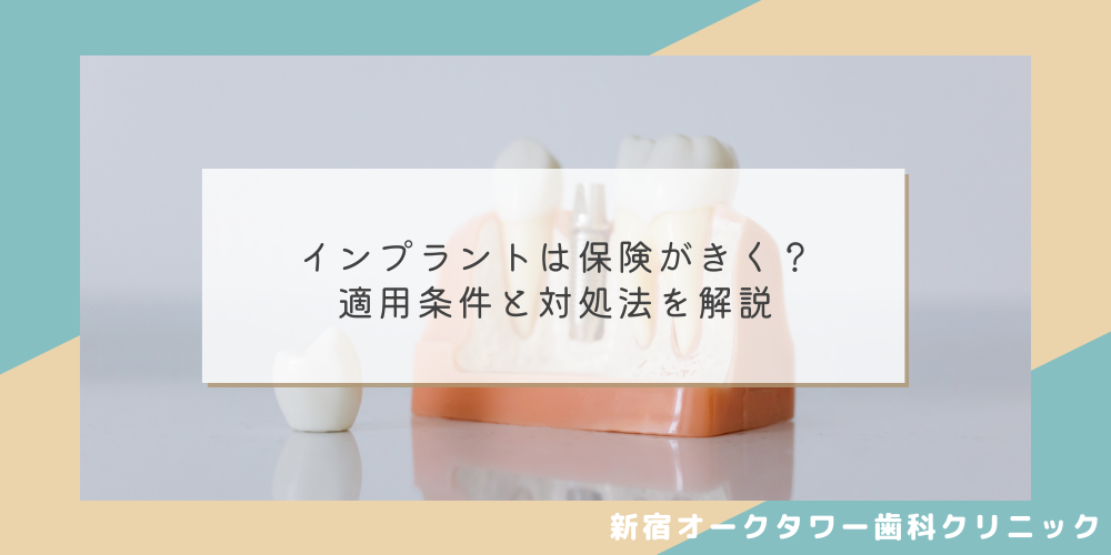 インプラントは保険がきく？適用条件と対処法を解説