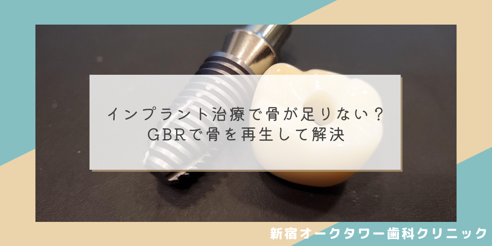 インプラント治療で骨が足りない？GBRで骨を再生して解決