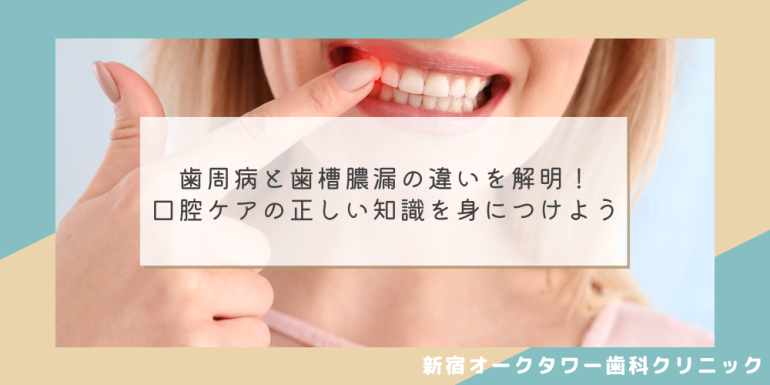 歯周病と歯槽膿漏の違いを解明!口腔ケアの正しい知識を身につけよう